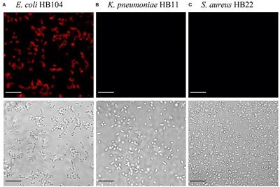 A Phage Receptor-Binding Protein as a Promising Tool for the Detection of Escherichia coli in Human Specimens